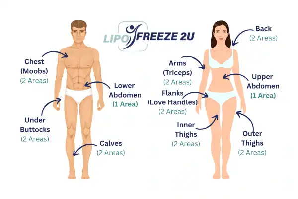 Areas you can have fat freezing treatment Scunthorpe
