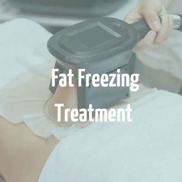 fat freezing treatment Scunthorpe