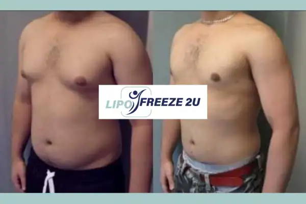 How Long Does It Take to See Results Scunthorpe?
