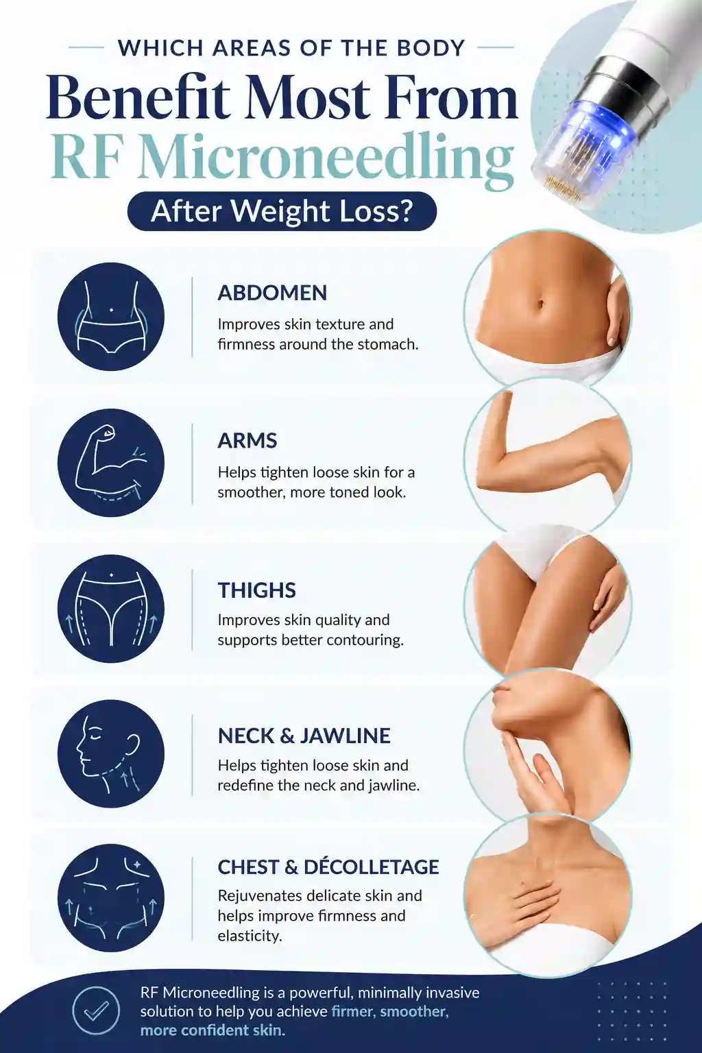 Which Areas of the Body Benefit Most From RF Microneedling After Weight Loss Scunthorpe
